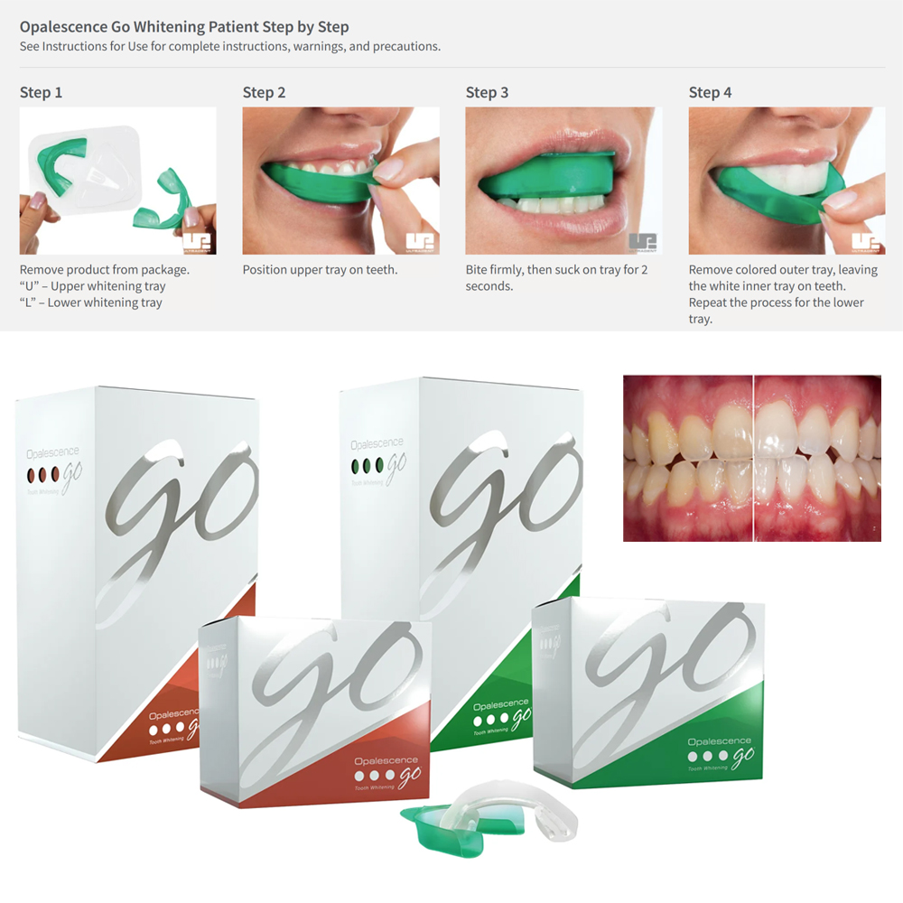 Teeth Whitening Opalescence Go - Opalesens Go Dental pemutih nampan preisi