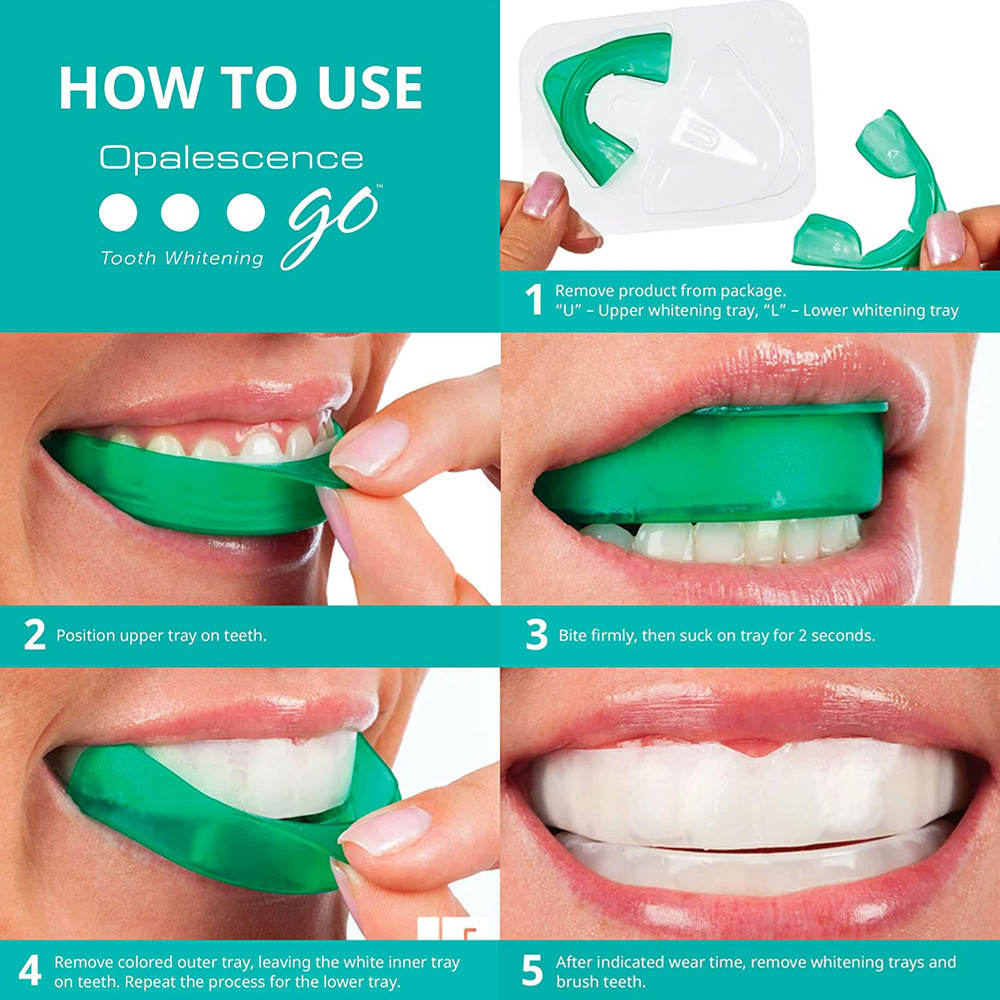 Hidrogen peroksida untuk pemut - Teeth Whitening Opalescence Go ulasan dan harga