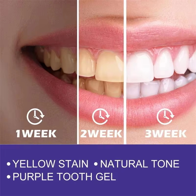 Pasta Gigi Pemutih Pembersih G - Teeth Whitening Korea ulasan dan harga