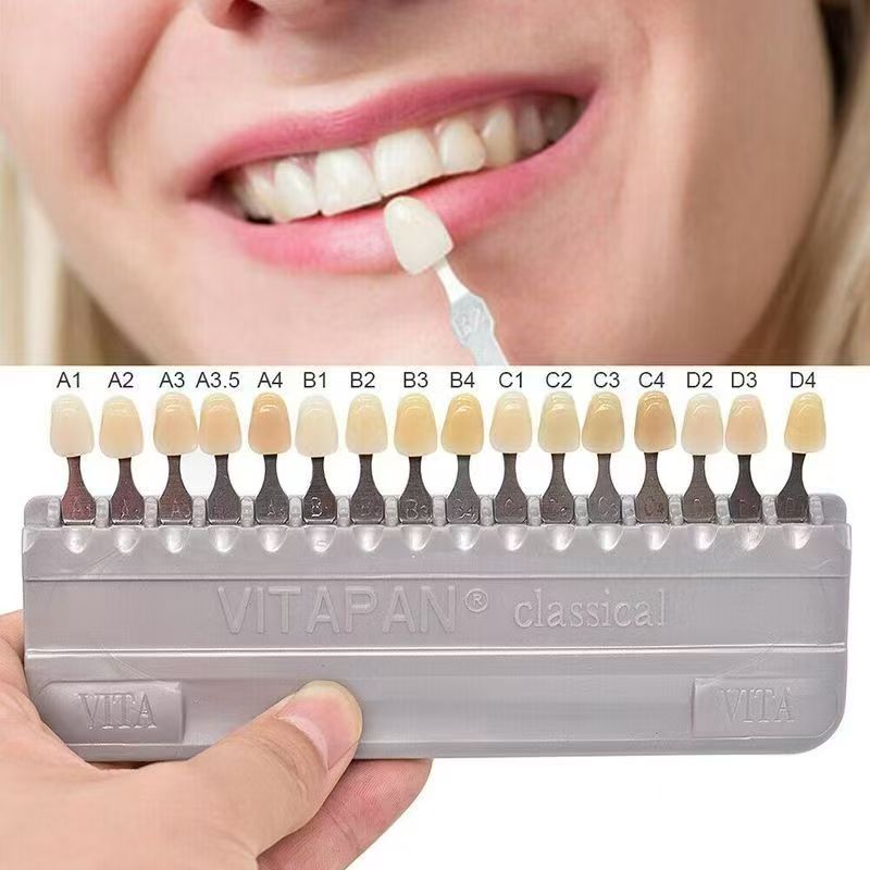 VITA 16 Warna Panduan Warna Gi - Teeth Whitening Dental ulasan dan harga