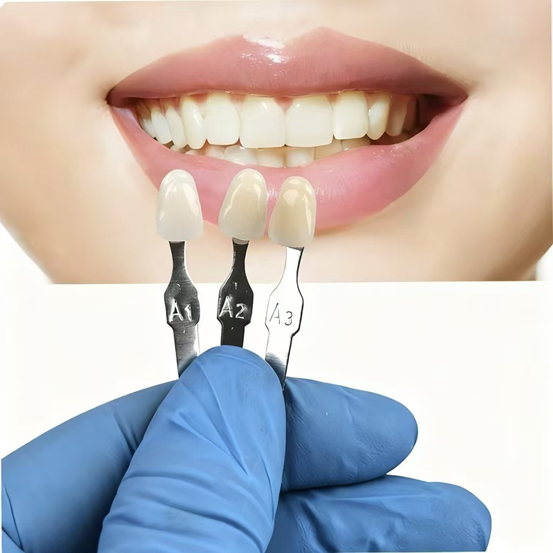 VITA 16 Warna Panduan Warna Gi - Teeth Whitening Dental ulasan dan harga