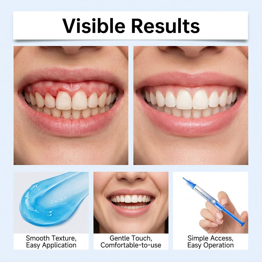 3 buah Gel Perawatan Gusi, Pen - Teeth Whitening Gum ulasan dan harga