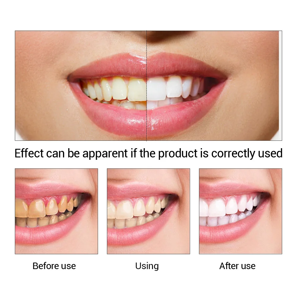 FTEENPLY Bubuk Esensi Pemutih  - Teeth Whitening Levels ulasan dan harga