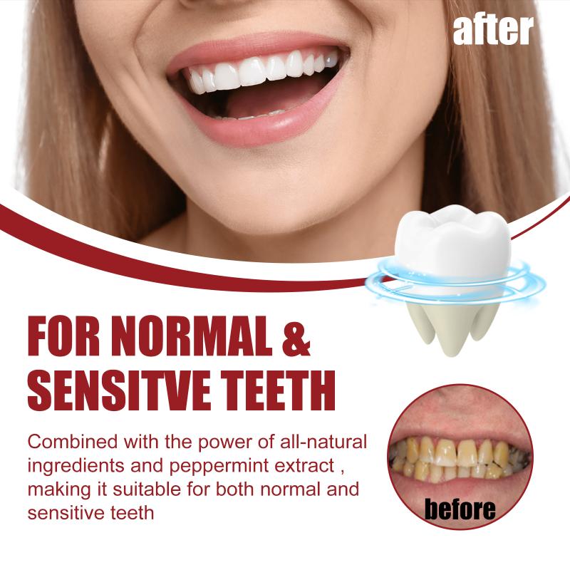 Pasta Gigi Probiotik SP-5 Memu - Teeth Whitening Foam Toothpaste ulasan dan harga