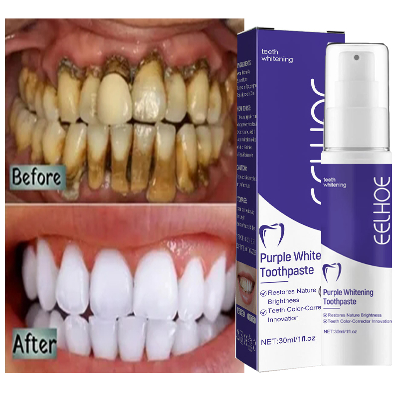 1 buah pasta gigi pemutih pemb - Teeth Whitening Korea ulasan dan harga