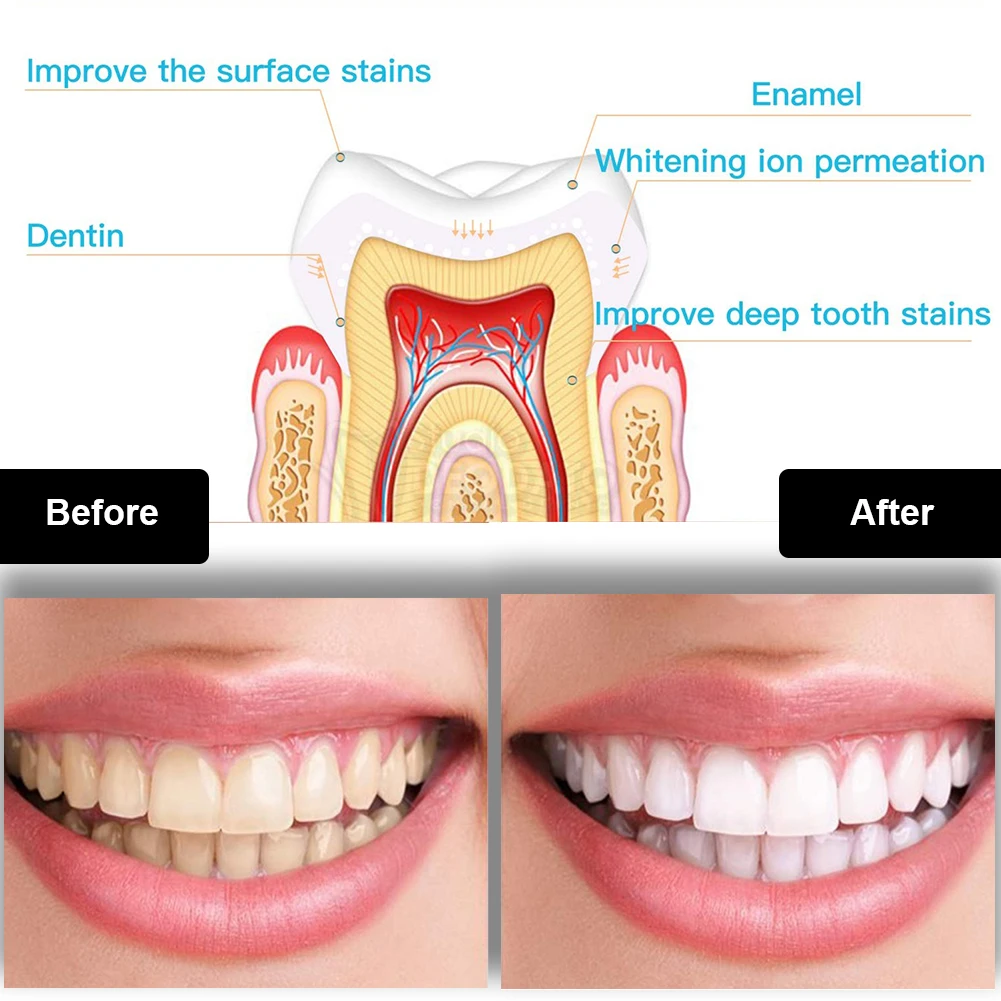 Kit pemutih gigi Mini 16 LED c - Teeth Whitening Levels ulasan dan harga