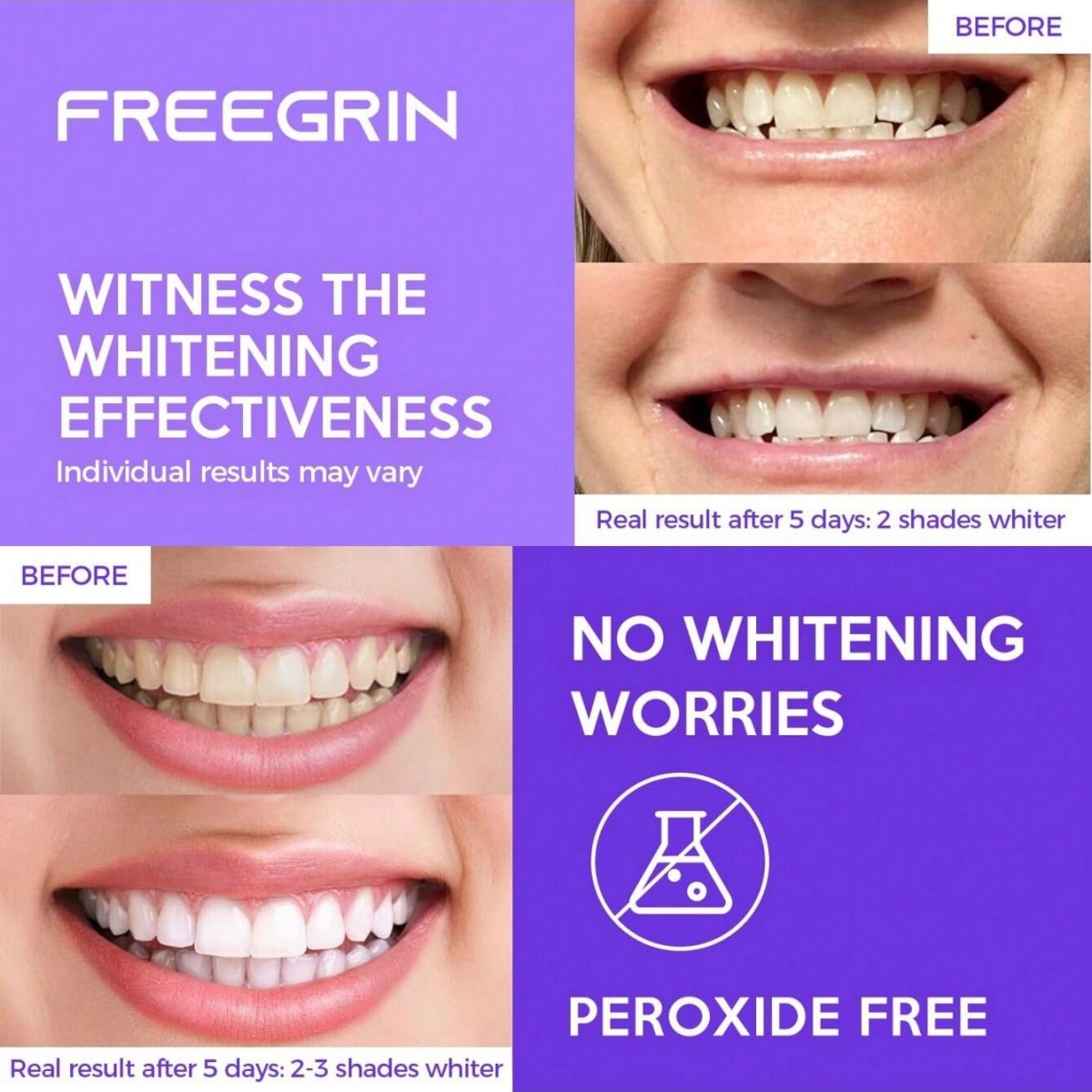 Stiker Gigi Pemutih Mewah 7/14 - Teeth Whitening Levels ulasan dan harga