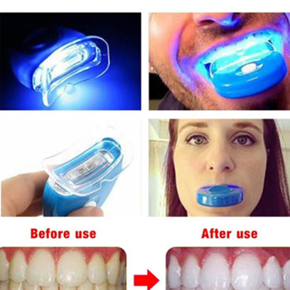 Baru Biru Led Akselerator Pemu - Teeth Whitening Laser ulasan dan harga