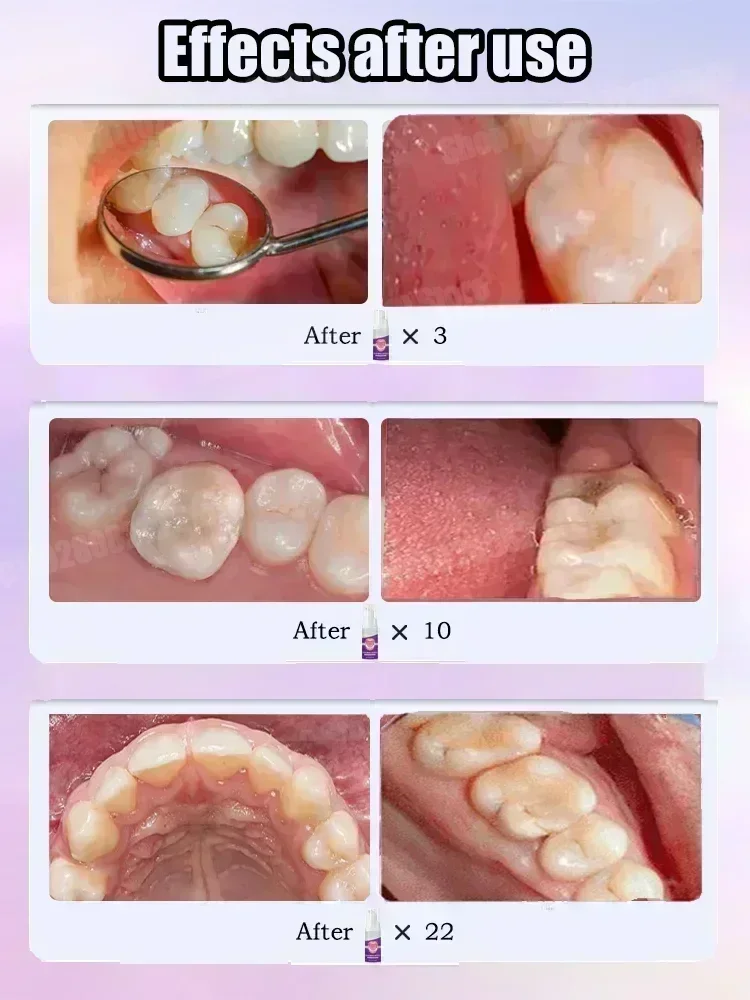 Pasta Gigi Pembersih Gigi Meng - Teeth Whitening Gum ulasan dan harga
