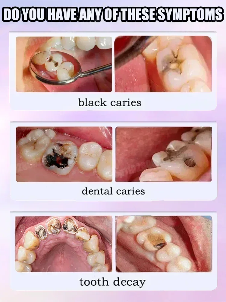 Pasta Gigi Pembersih Gigi Meng - Teeth Whitening Gum ulasan dan harga